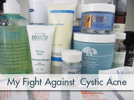 huidverzorgingsproducten op een tafel met de tekst mijn strijd tegen cystische acne op de foto geschreven